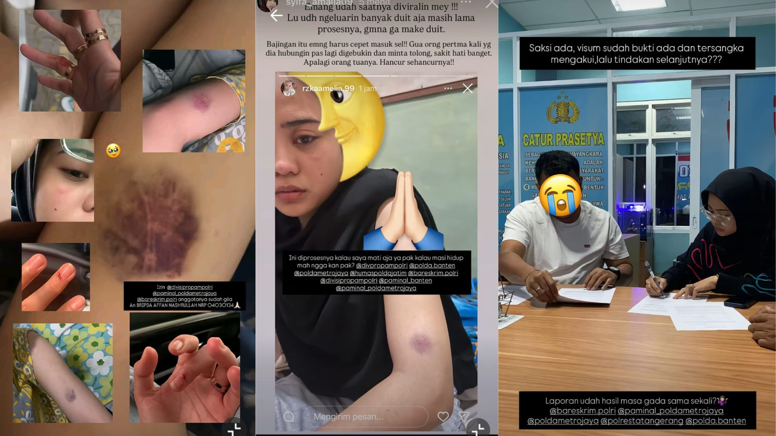 Oknum Polisi Diduga Lakukan Penganiayaan, Aktivis Mahasiswa: Pecat dari Institusi Polri